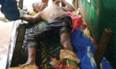 प्रेशर बम की चपेट में बालक जख्मी