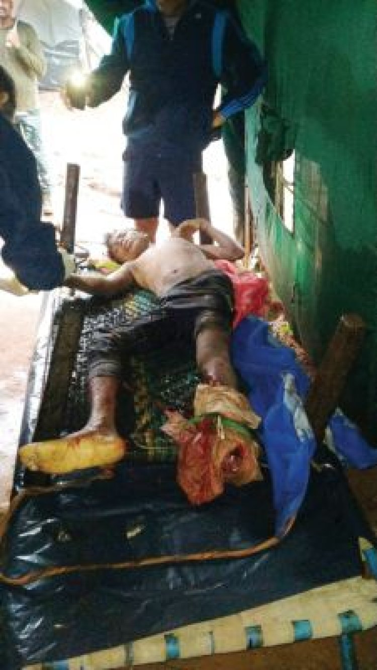 प्रेशर बम की चपेट में बालक जख्मी