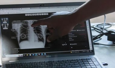 भारत को टीबी मुक्त बनाने की दिशा में आ रही अड़चनें